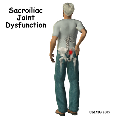 Sacroiliac Joint Pain Relief Tips